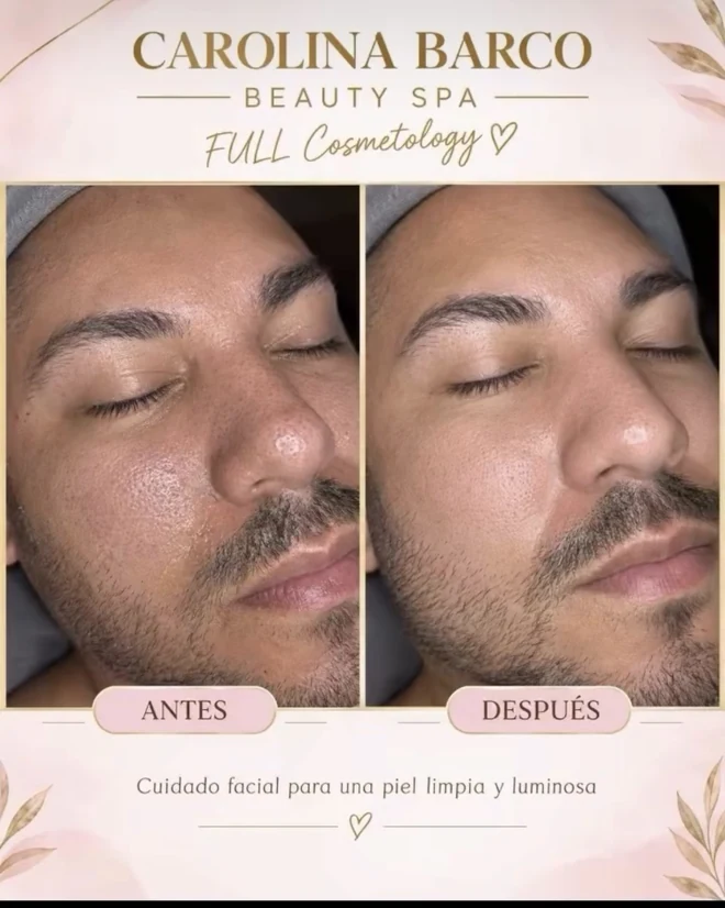 Cuidado facial: publicación de antes y después